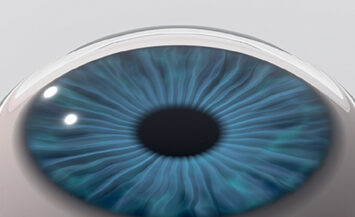 CLEAR LASIK Surgery Process Images 3