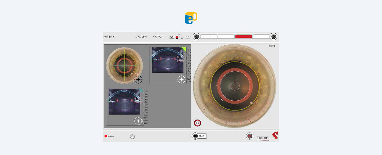 手術優點說明圖片 2